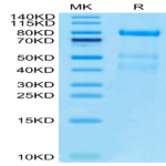 Human Complement factor I Protein (CFI-HM101)