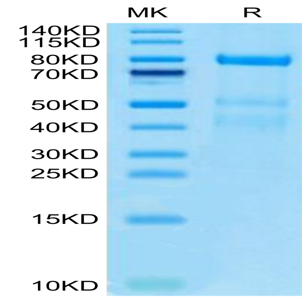 Human Complement factor I Protein (CFI-HM101)