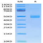 Human CTGF/CCN2 Protein (CGF-HM101)