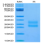 Biotinylated Human CTGF/CCN2 Protein BP004223 Syd Labs