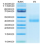 Human CLEC10A Protein (CLE-HM10B)