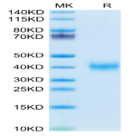 Mouse CLEC10A Protein (CLE-MM10A)