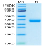 SARS-COV-2 Spike RBD (Omicron B.1.1.529) Protein (COV-VM1RO)