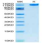 SARS-COV-2 Spike S1 Protein (COV-VM1S1)