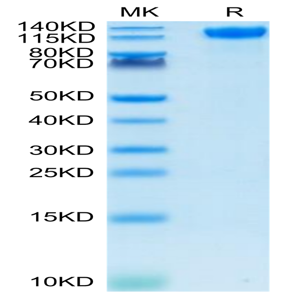 SARS-COV-2 Spike S1 Protein (COV-VM1S1)