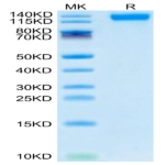 SARS-COV-2 Spike S1 (Omicron B.1.1.529) Protein (COV-VM1SO)