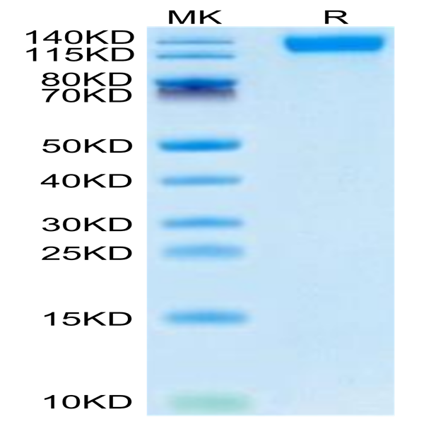 SARS-COV-2 Spike S1 (Omicron B.1.1.529) Protein (COV-VM1SO)