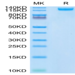 SARS-COV-2 Spike S1 (N501Y) Protein (COV-VM1SY)