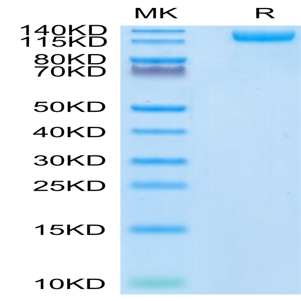 SARS-COV-2 Spike S1 (N501Y) Protein (COV-VM1SY)