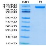 SARS-COV-2 Spike S1 (D614G) Protein (COV-VM4SG)