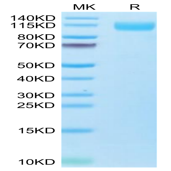 Biotinylated SARS-COV-2 Spike S1 (Omicron B.1.1.529) Protein (COV-VM4SOB)
