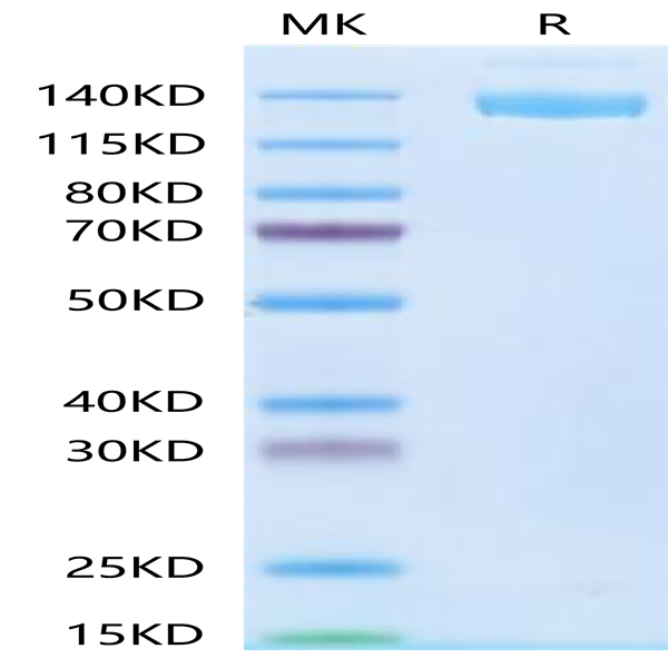 SARS-COV-2 Spike S Trimer Protein (COV-VM4SS)
