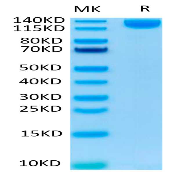 SARS-COV-2 Spike S1 Protein (COV-VM5S1)