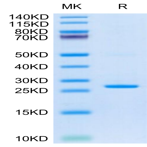 Cynomolgus C-Reactive Protein /CRP Protein (CRP-CM102)