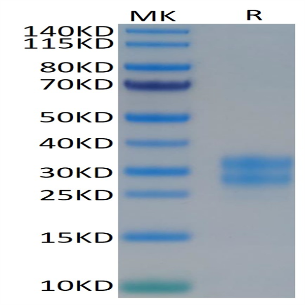 Human M-CSF/CSF-1 Protein (CSF-HM401)