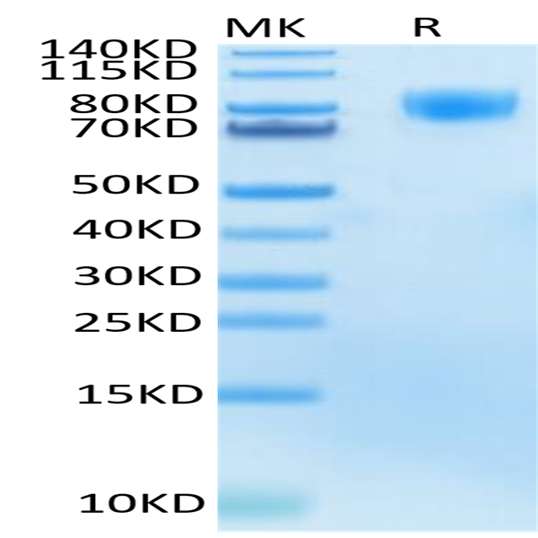 Human M-CSF R/CSF1R/CD115 Protein (CSF-HM41R)