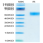 Mouse GM-CSF R alpha Protein (CSF-MM12R)