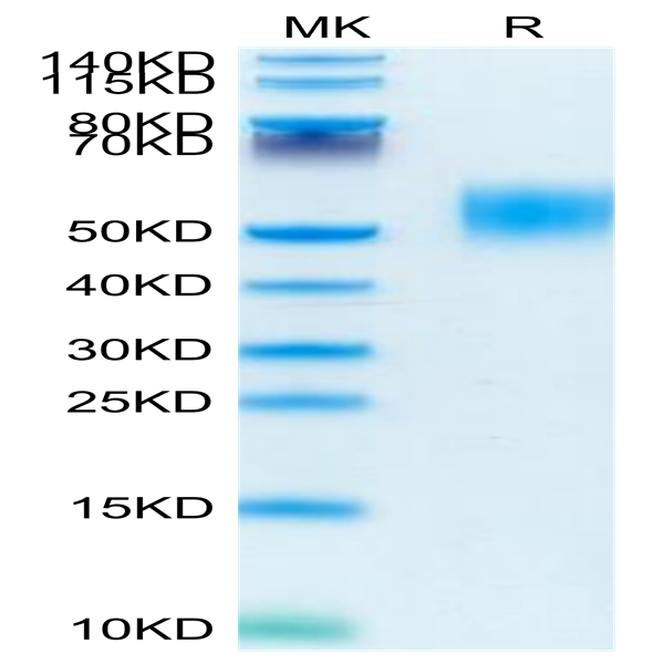Mouse GM-CSF R alpha Protein (CSF-MM12R)