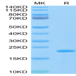 Biotinylated SARS-COV-2 Nucleocapsid Protein CTD Domain Protein (CTD-VE4NPB)