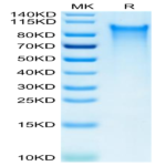 Human CX3CL1/Fractalkine Protein (CX3-HM101)