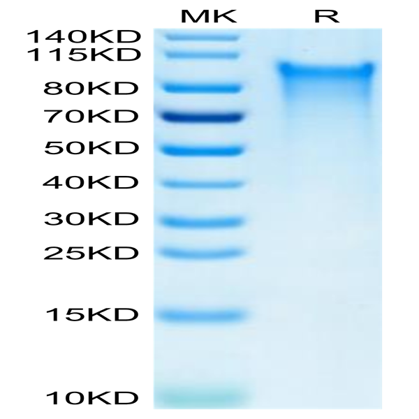 Human CX3CL1/Fractalkine Protein (CX3-HM101)