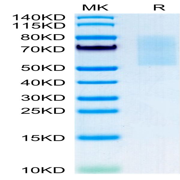 Mouse CX3CL1/Fractalkine Protein (CX3-MM101)