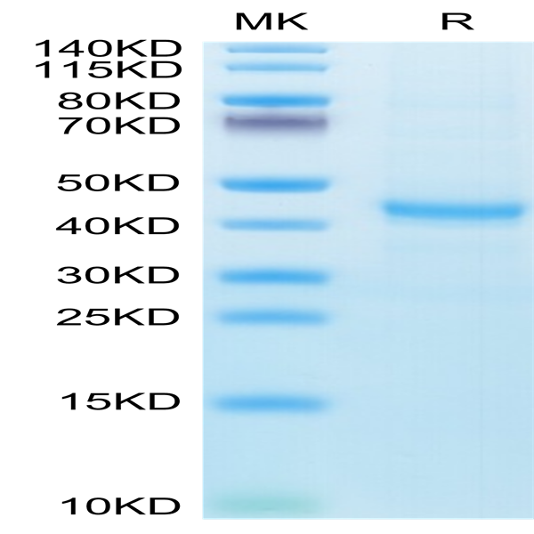 Human CXCL13/BCA-1 Protein (CXC-HM213)