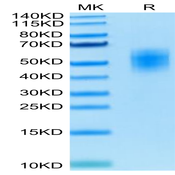 Human DNAM-1/CD226 Protein (DAM-HM101)