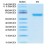 Human DDR1 Protein (DDR-HM1R1)