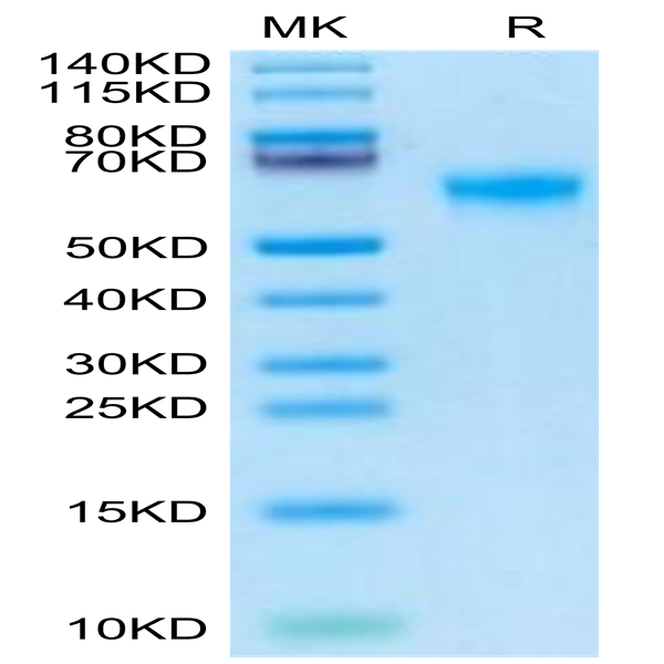 Human DDR2 Protein (DDR-HM1R2)