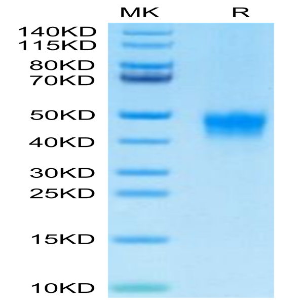 Biotinylated Human DKK1 Protein (DKK-HM401B)