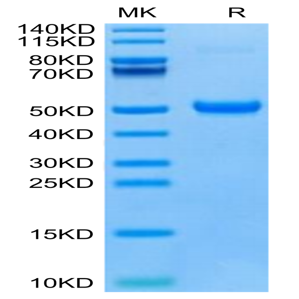 Human DKK1 C terminal Domain Protein (DKK-HM51C)