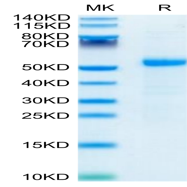 Human DLL3 Protein (DLL-HM103)