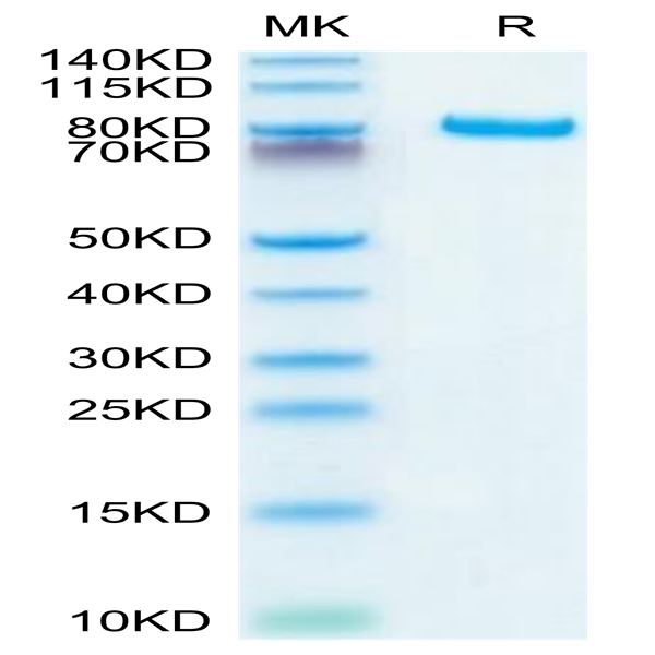 Human DLL4 Protein (DLL-HM204)