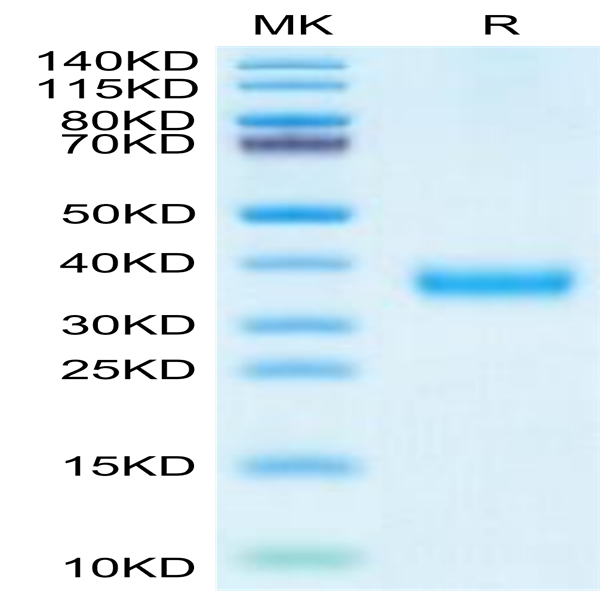 SARS-CoV-2 Spike RBD (Delta plus AY.1/AY.2) Protein (DP1-VM1BD)