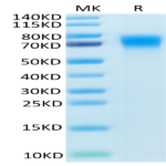 Mouse DR6/TNFRSF21 Protein BP004831 Syd Labs