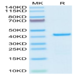 Human EMAP-II/AIMP1 Protein (EAP-HE102)