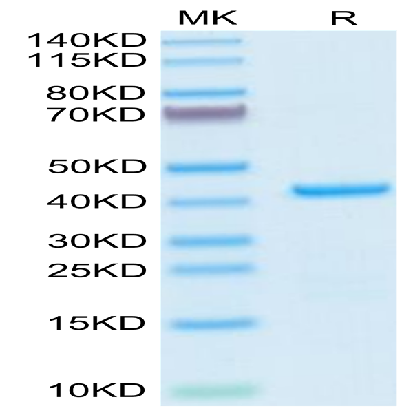 Human EMAP-II/AIMP1 Protein (EAP-HE102)