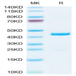 Mouse EMAP-II/AIMP1 Protein BP004429 Syd Labs