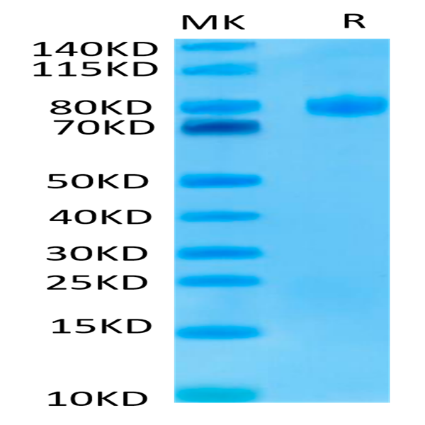 Human Endoglin/CD105 Protein (EDG-HM401)