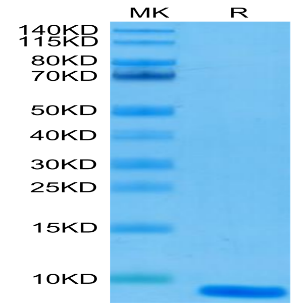 Human EGF Protein (EGF-HE001)