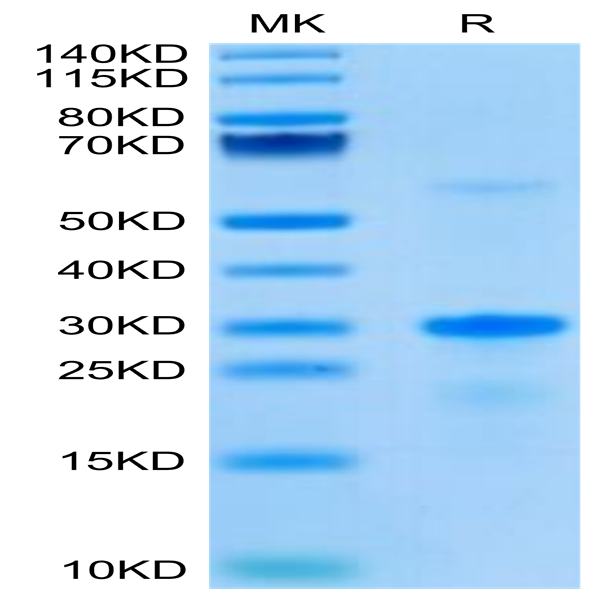 Human EGFL7 Protein (EGF-HE1L7)