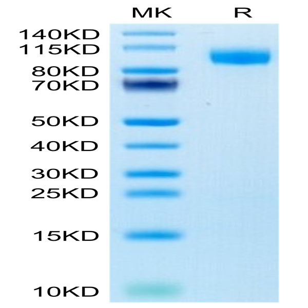 Human EGFR/HER1 Protein (EGF-HM401)