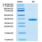 Mouse EGF Protein (EGF-MM202)