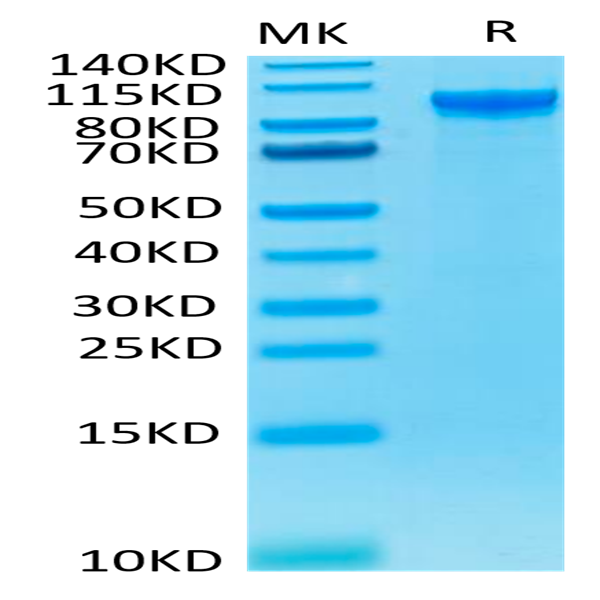 Human ENPP-2/Autotaxin Protein (ENP-HM101)