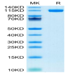 Human ENPP-1 Protein BP004294 Syd Labs