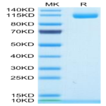 Human ENPP-1 Protein BP004291 Syd Labs