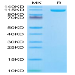 Biotinylated Human ENPP-1 Protein BP004180 Syd Labs
