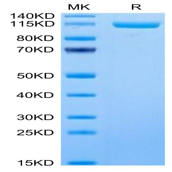 Human ENPP-3 Protein (ENP-HM403)