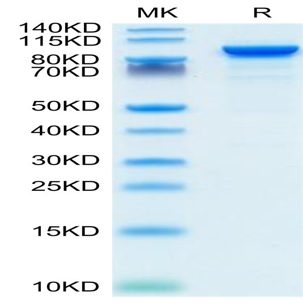 Mouse ENPP-2/Autotaxin Protein (ENP-MM101)